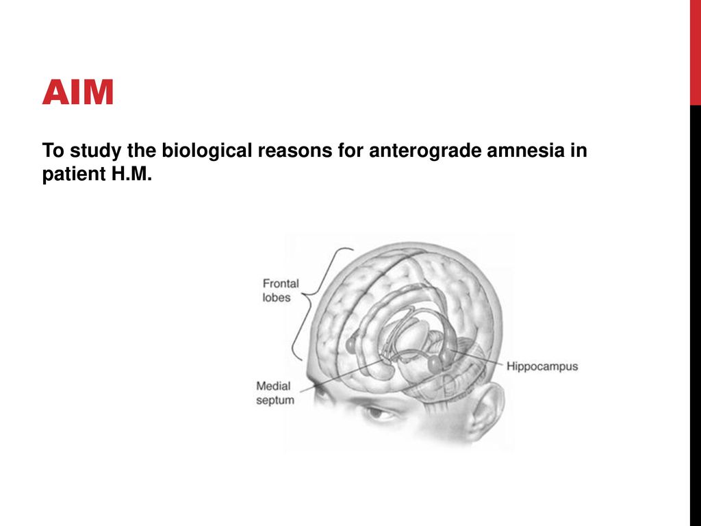 Amnesia case study 2025 hm